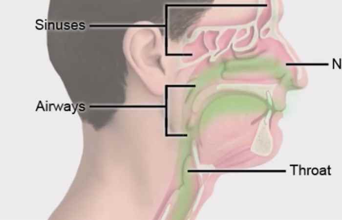 Sống khỏe 360 -  Vì sao mùa lạnh dễ bị viêm họng (10-01-2020)